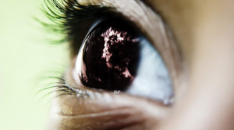 Minority kids at disadvantage, community survey shows