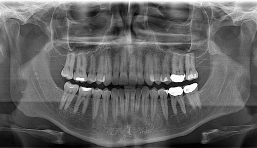 New bill would remedy nation’s “dental crisis”