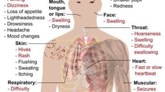 Drug companies charged with deceiving public on prescription painkillers