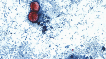 The systemic problem with the CDC’s response to the Cyclospora outbreak