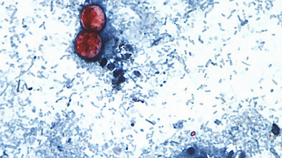 The systemic problem with the CDC’s response to the Cyclospora outbreak